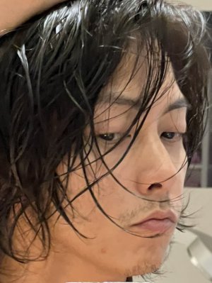 ニキビとおてて♡♡♡♡♡